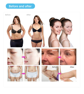 Legacy Skin Tightening Machine ( Medical Grade)